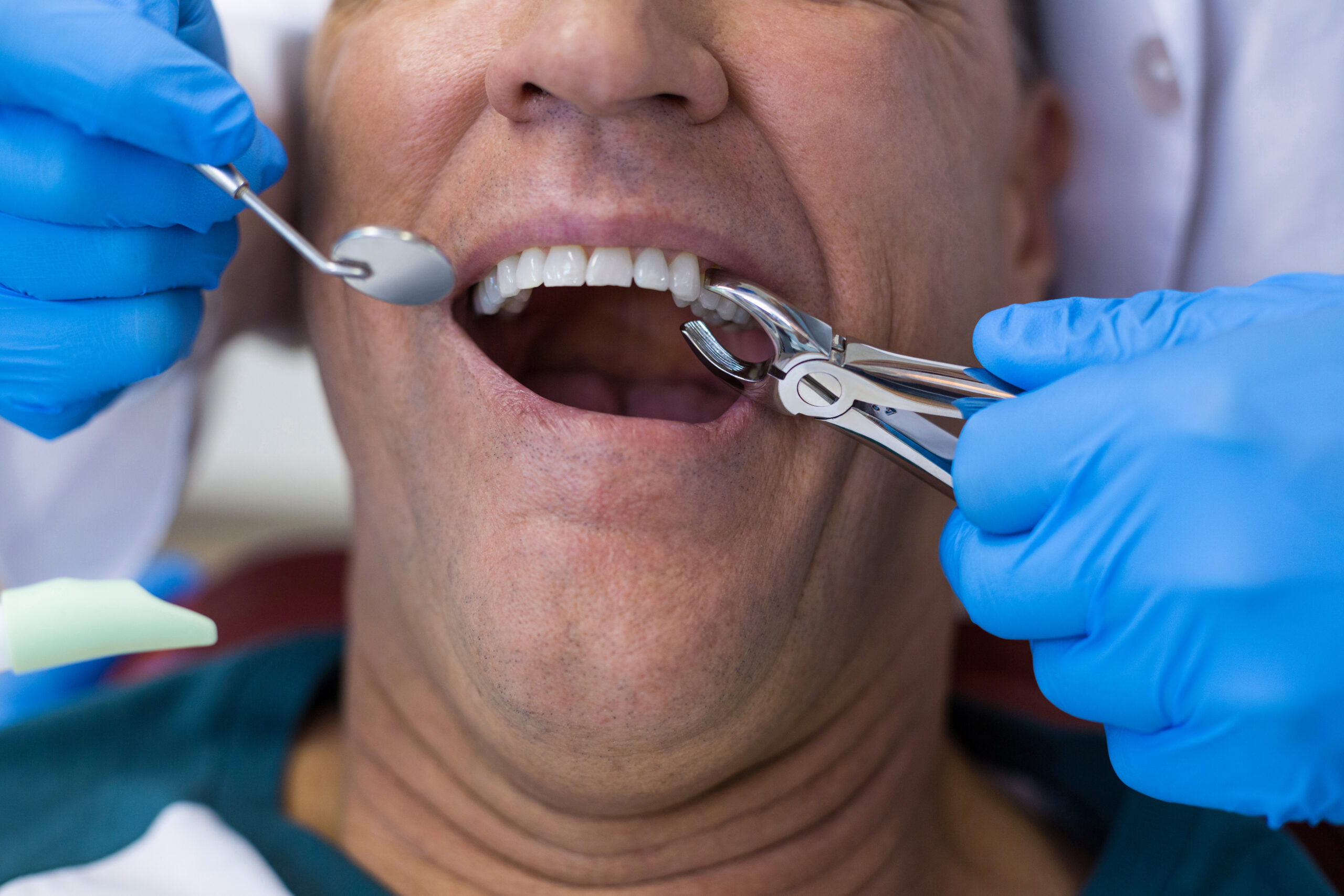 Holistic Approach Matters in Tooth Removal Decisions in Hayden ID